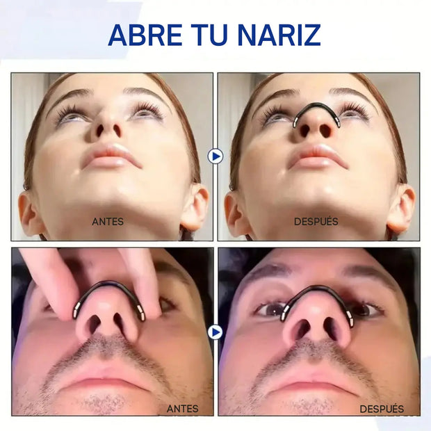 Dilatador Nasal